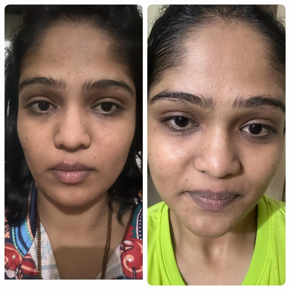 A student photographed front-on before and after Face Yoga practice