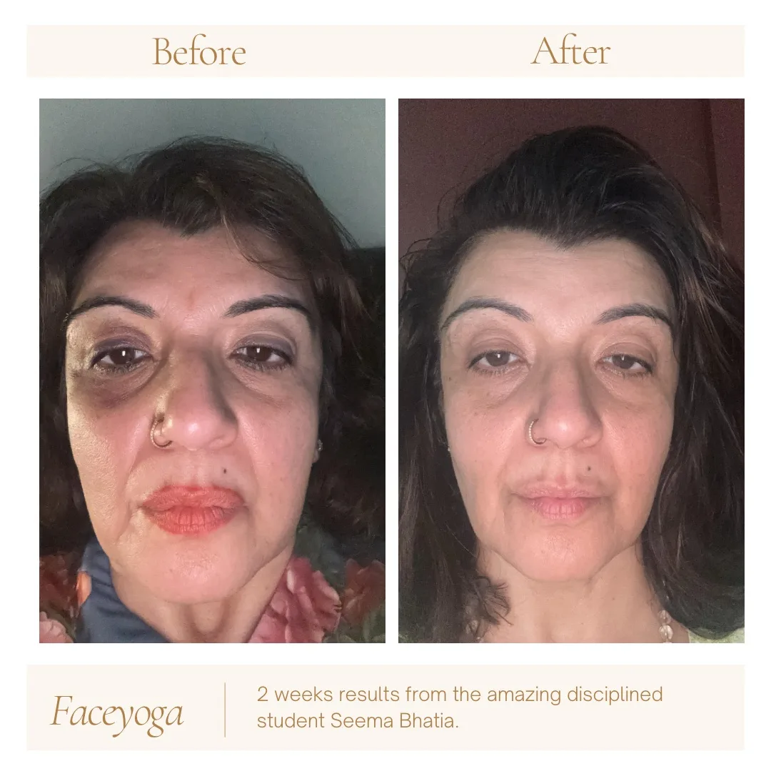 Seema Bhatia before and after two weeks of Face Yoga practice
