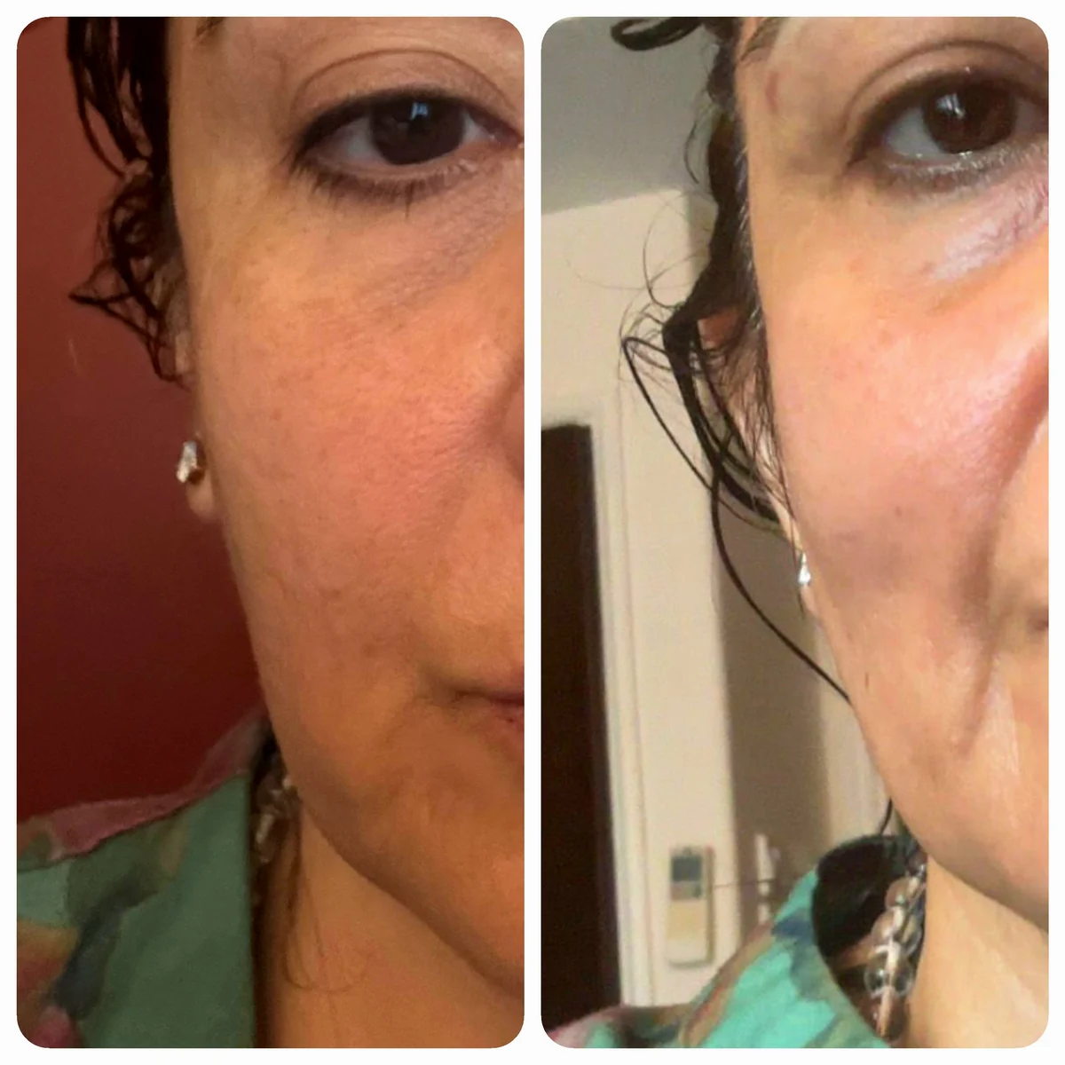 Close-up of a student's eye and cheek area, before and after practice